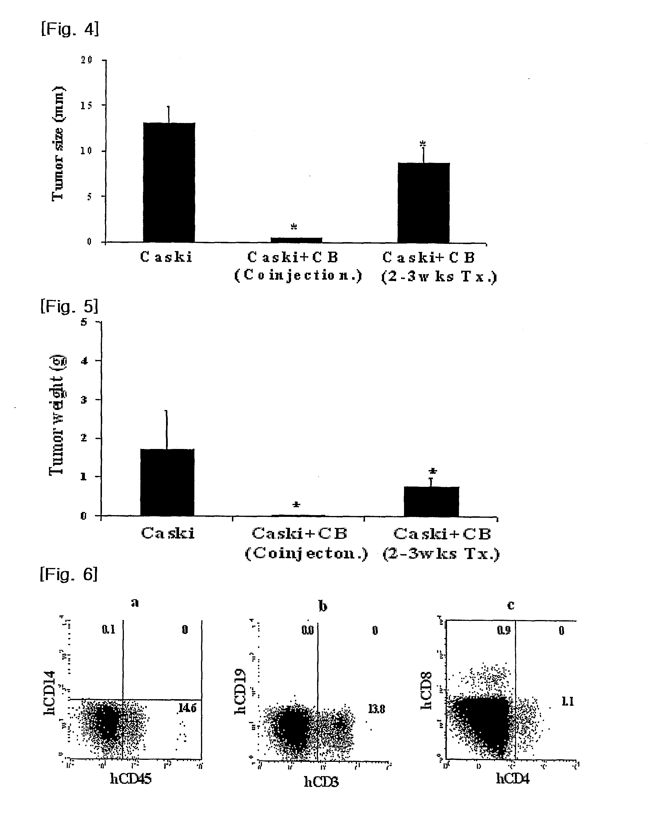 Composition for in vivo transplantation for treatment of human cervical cancer comprising mononuclear cells derived from umblical cord blood