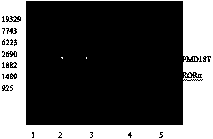 Nuclear orphan receptor alpha adeno-associated virus vector related to retinoic acid in mice