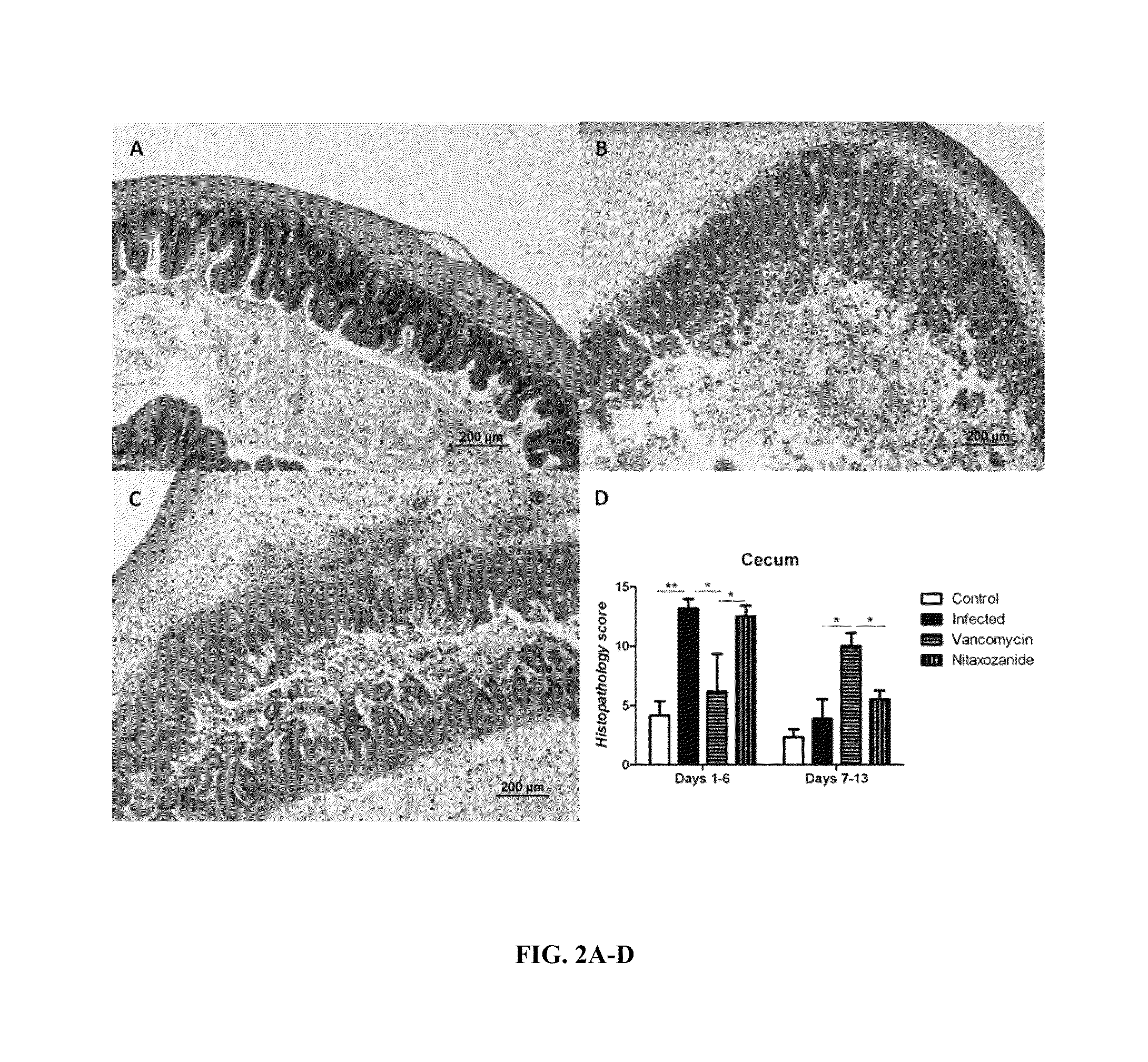 Compositions and methods for treating clostridium infection and preventing recurrence of infection