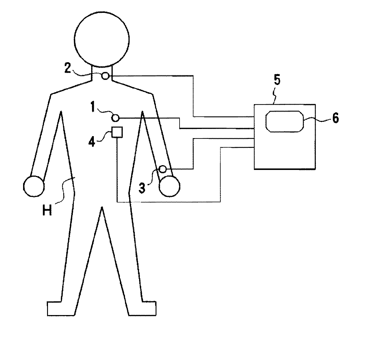 Arteriosclerosis diagnostic device