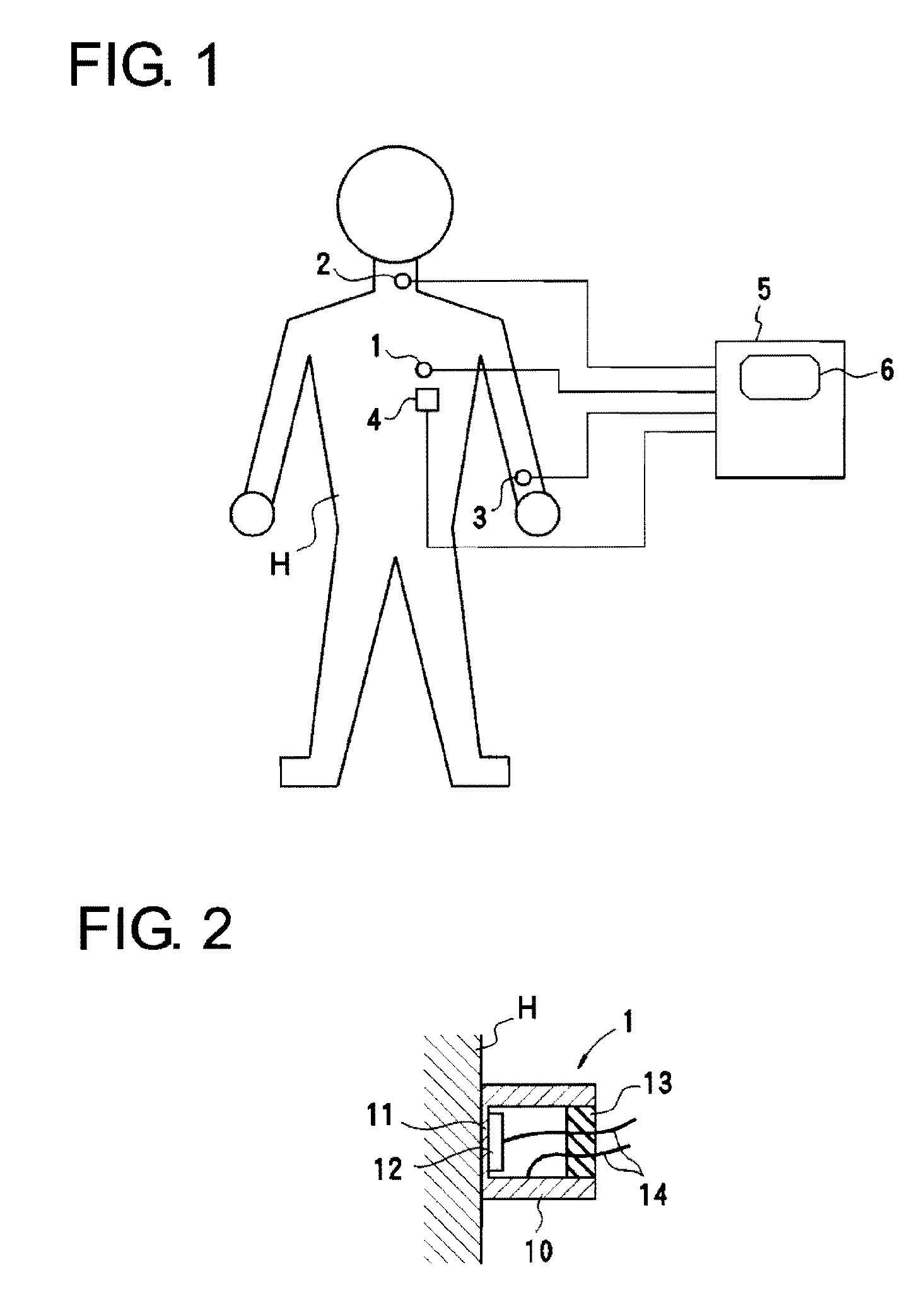 Arteriosclerosis diagnostic device