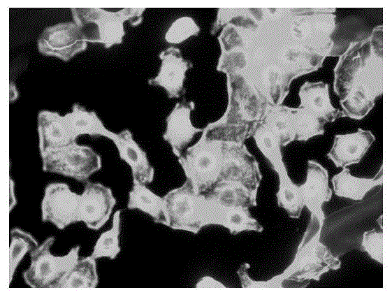 Application of pyrazinamide in the preparation of drugs for inhibiting tumor cell metastasis and spread