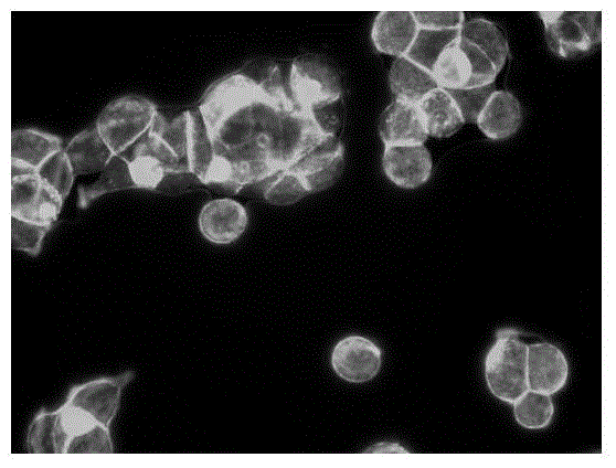 Application of pyrazinamide in the preparation of drugs for inhibiting tumor cell metastasis and spread