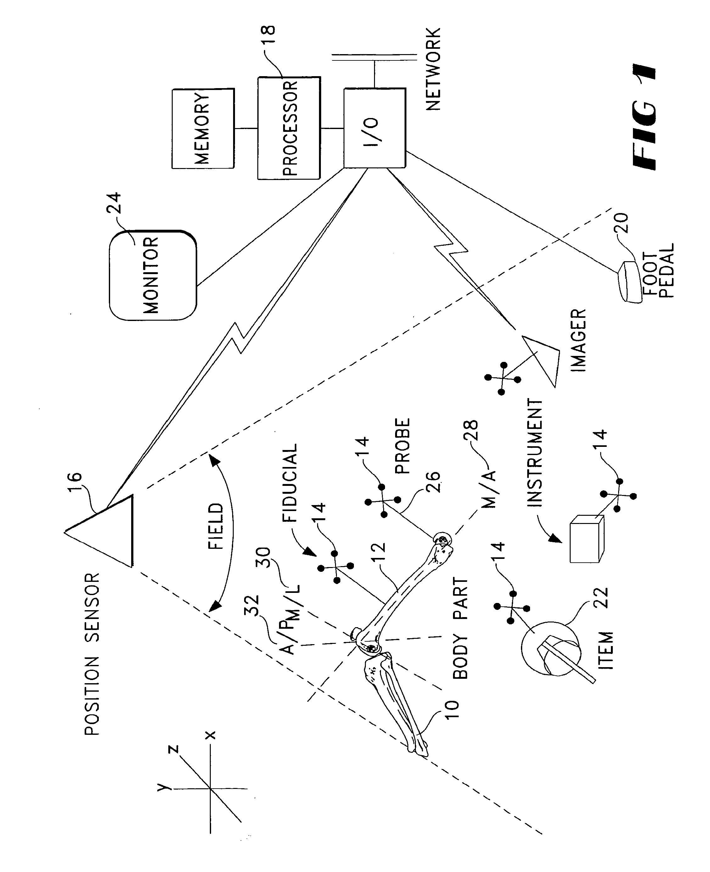 Computer Assisted Knee Arthroplasty Instrumentation, Systems, and Processes