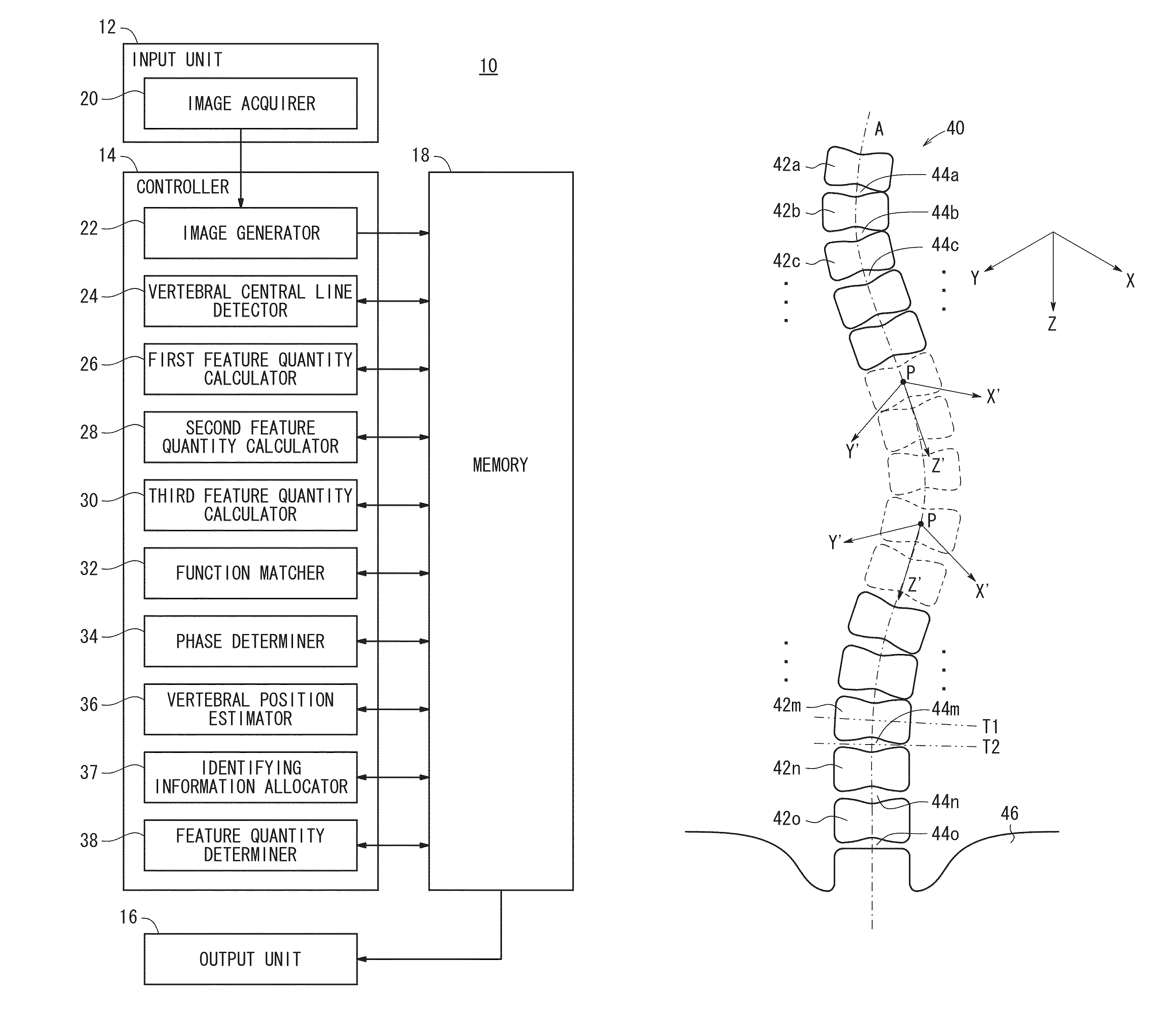 Vertebra segmentation apparatus, vertebra segmentation method, and recording medium with program for vertebra segmentation