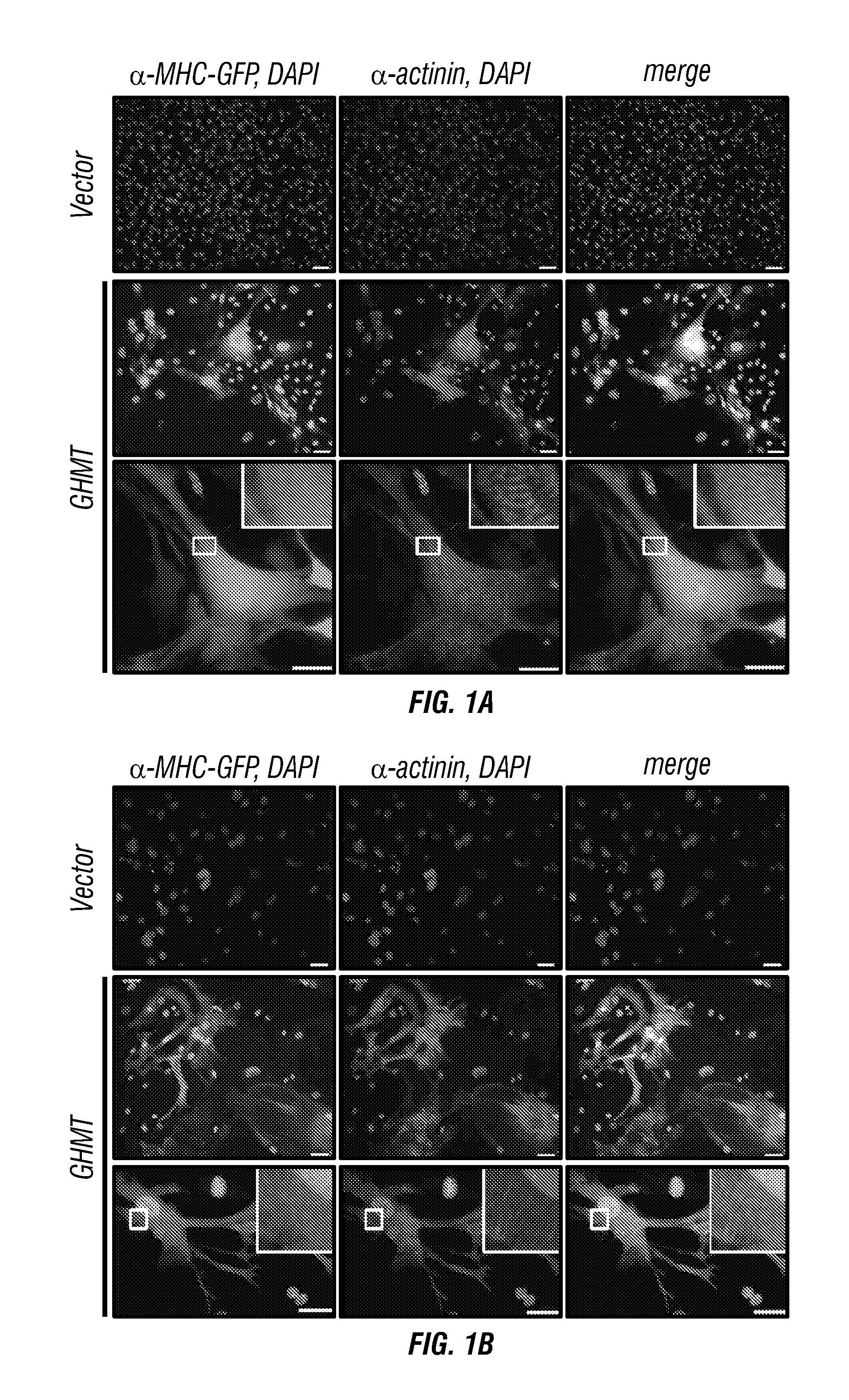 Cardiac repair by reprogramming of cardiac fibroblasts into cardiomyocytes