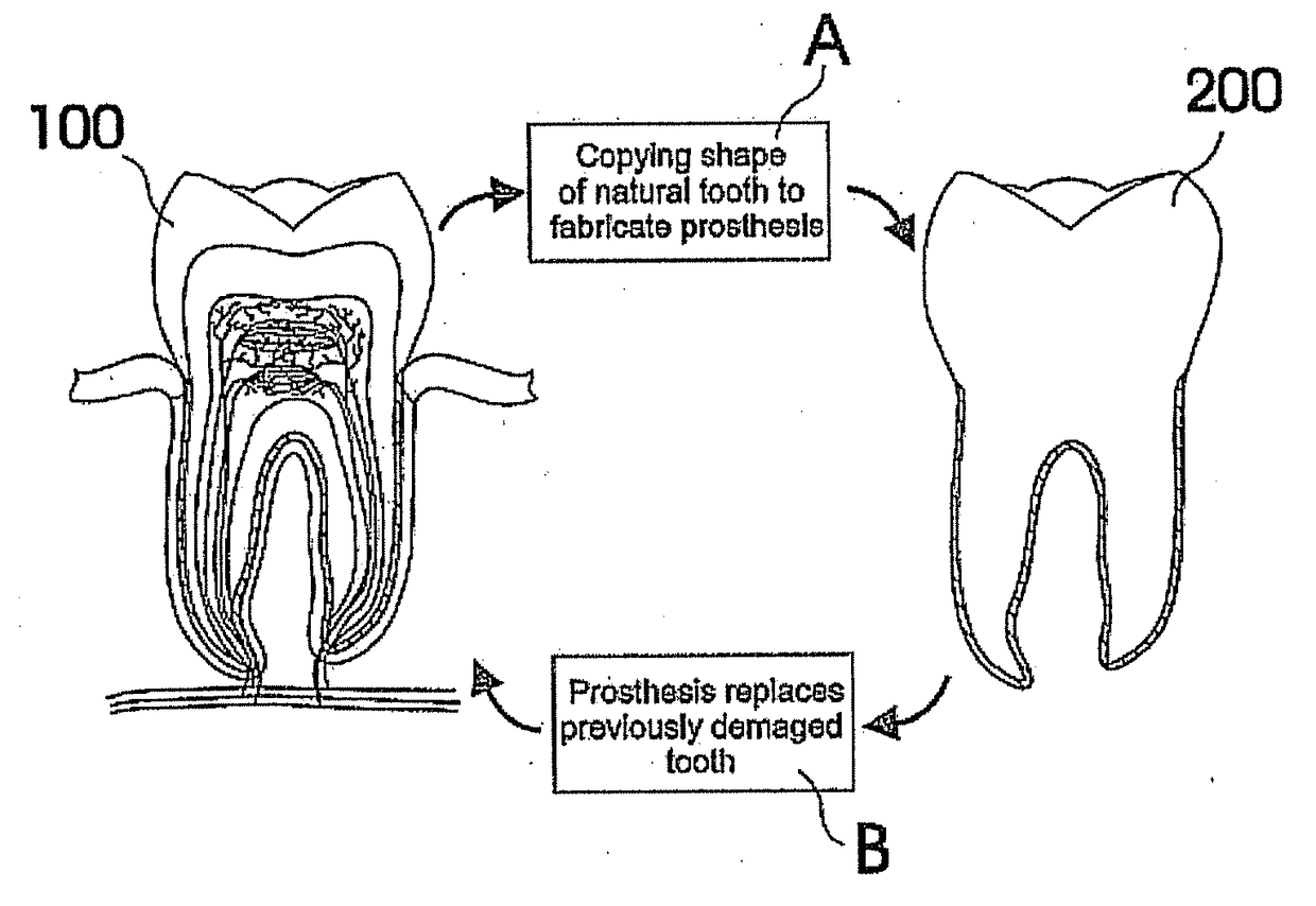 Customized Dental Prosthesis For Periodontal or Osseointegration and Related Systems