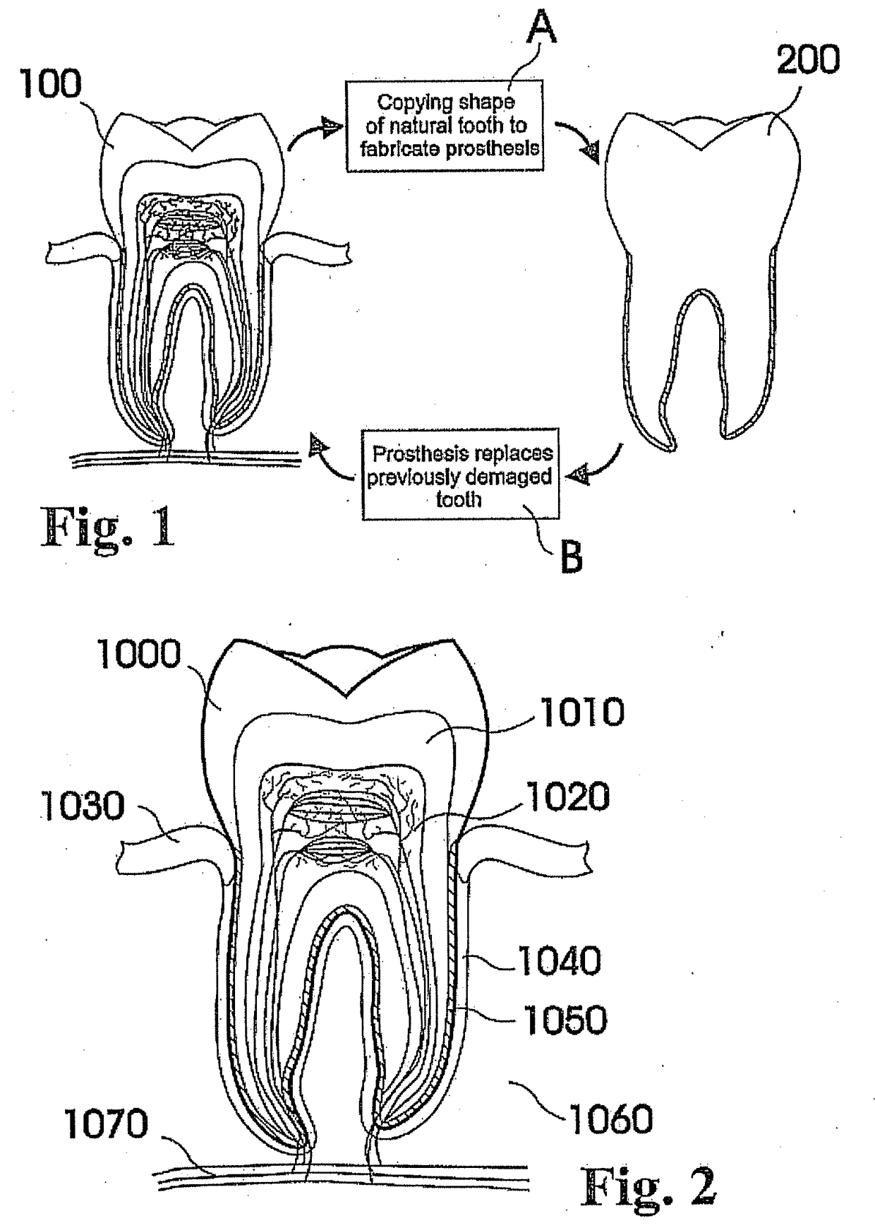 Customized Dental Prosthesis For Periodontal or Osseointegration and Related Systems