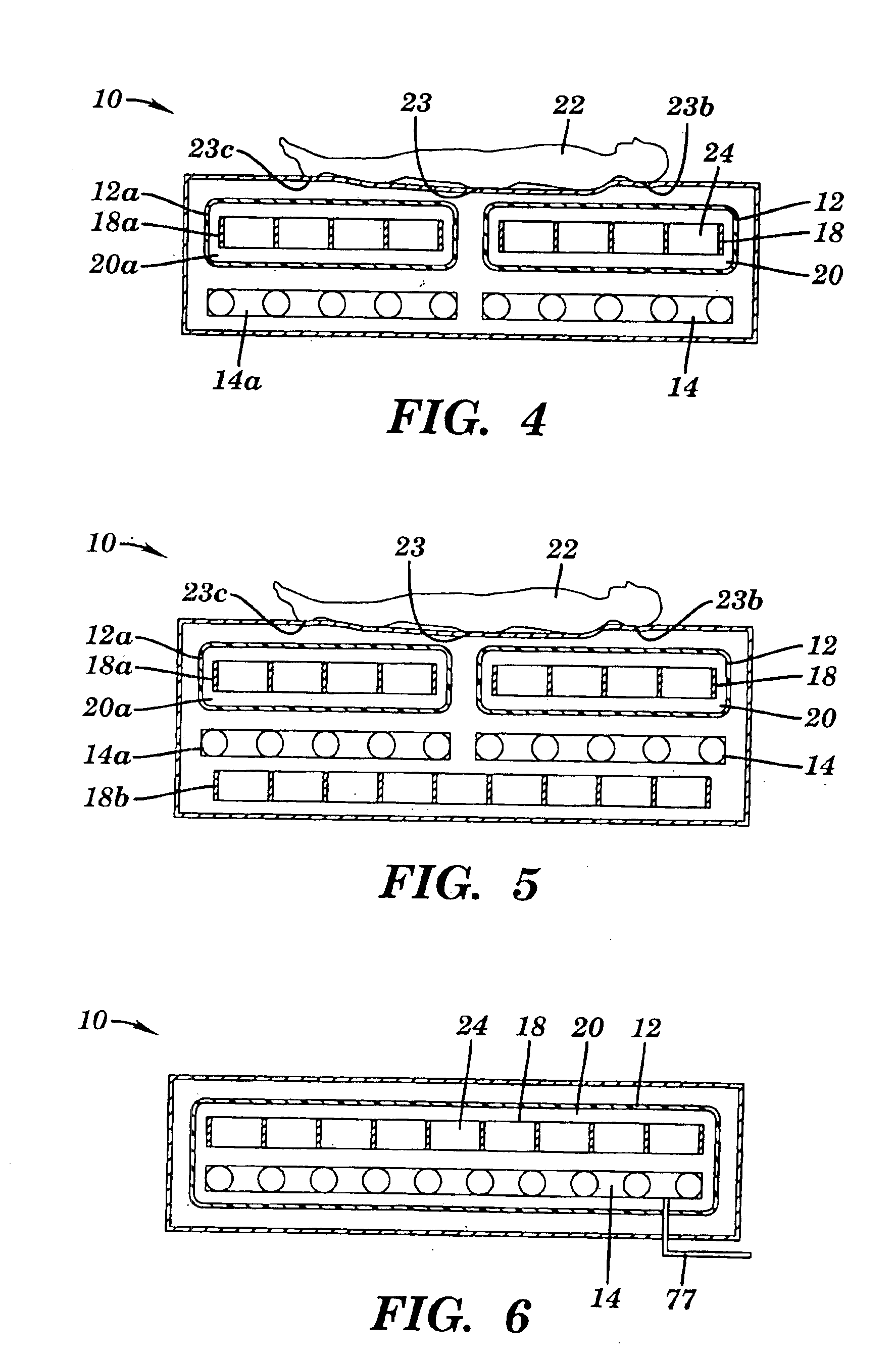 Supported hypo/hyperthermia pad