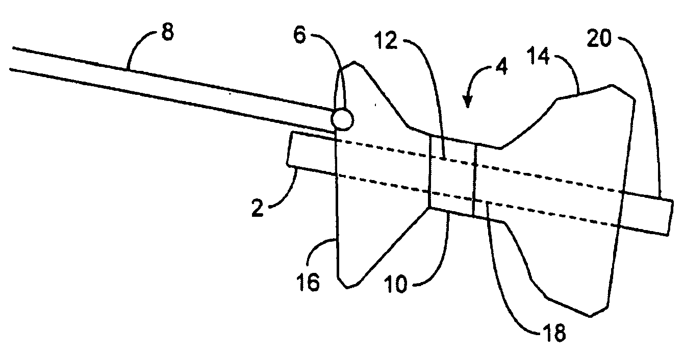 Gastric retaining devices and methods