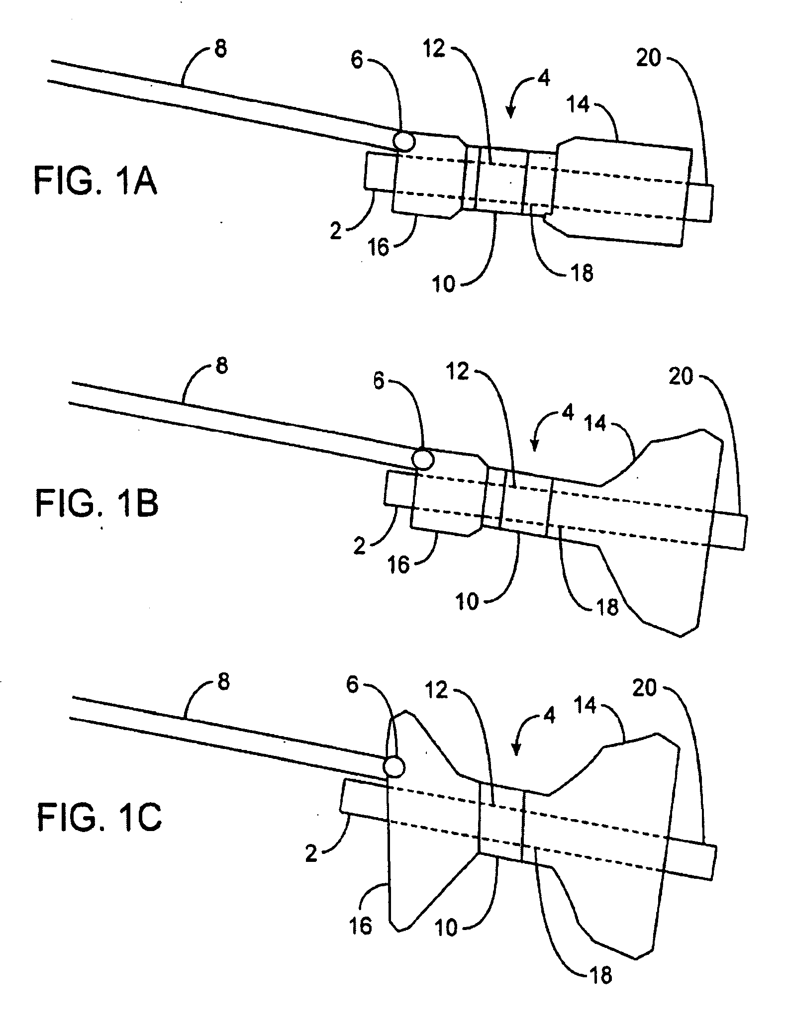 Gastric retaining devices and methods