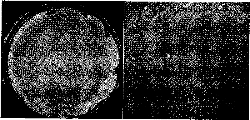 Method for preparing Lactobacillus casei microcapsule