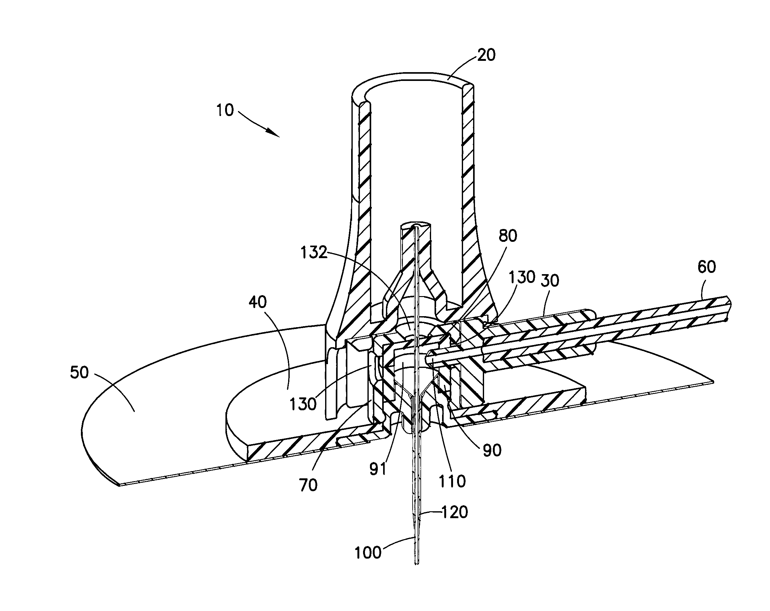 Subcutaneous Infusion Set With Side Port Fluid Connector