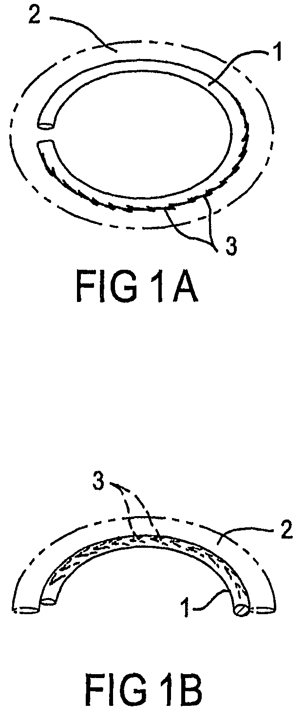 Treating valve failure