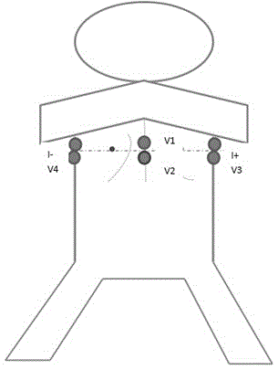 A method and system for analyzing the correlation between left and right lung respiratory impedance