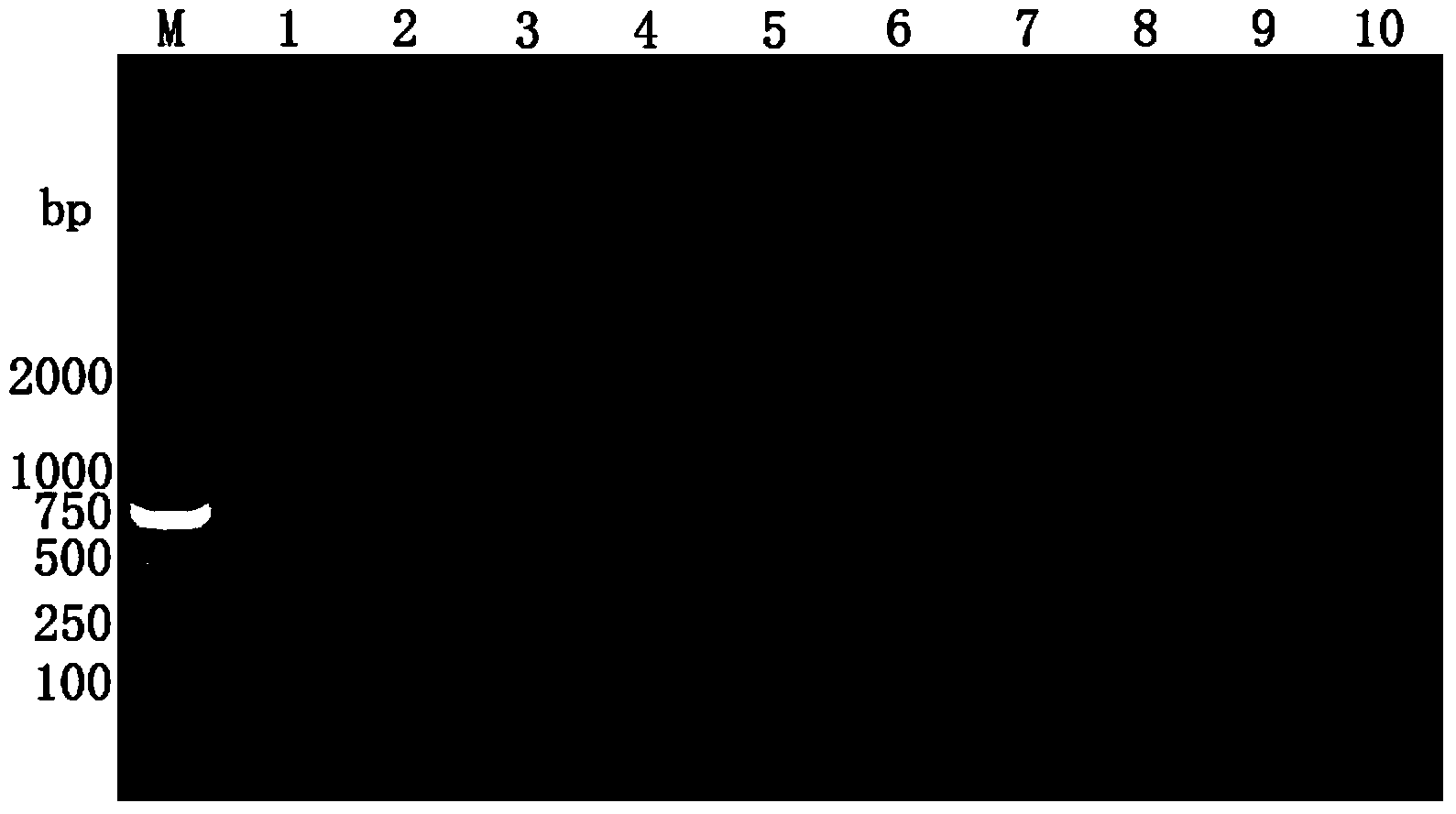 Detection kit and detection method for siniperca chuatsi rhabdoviruses