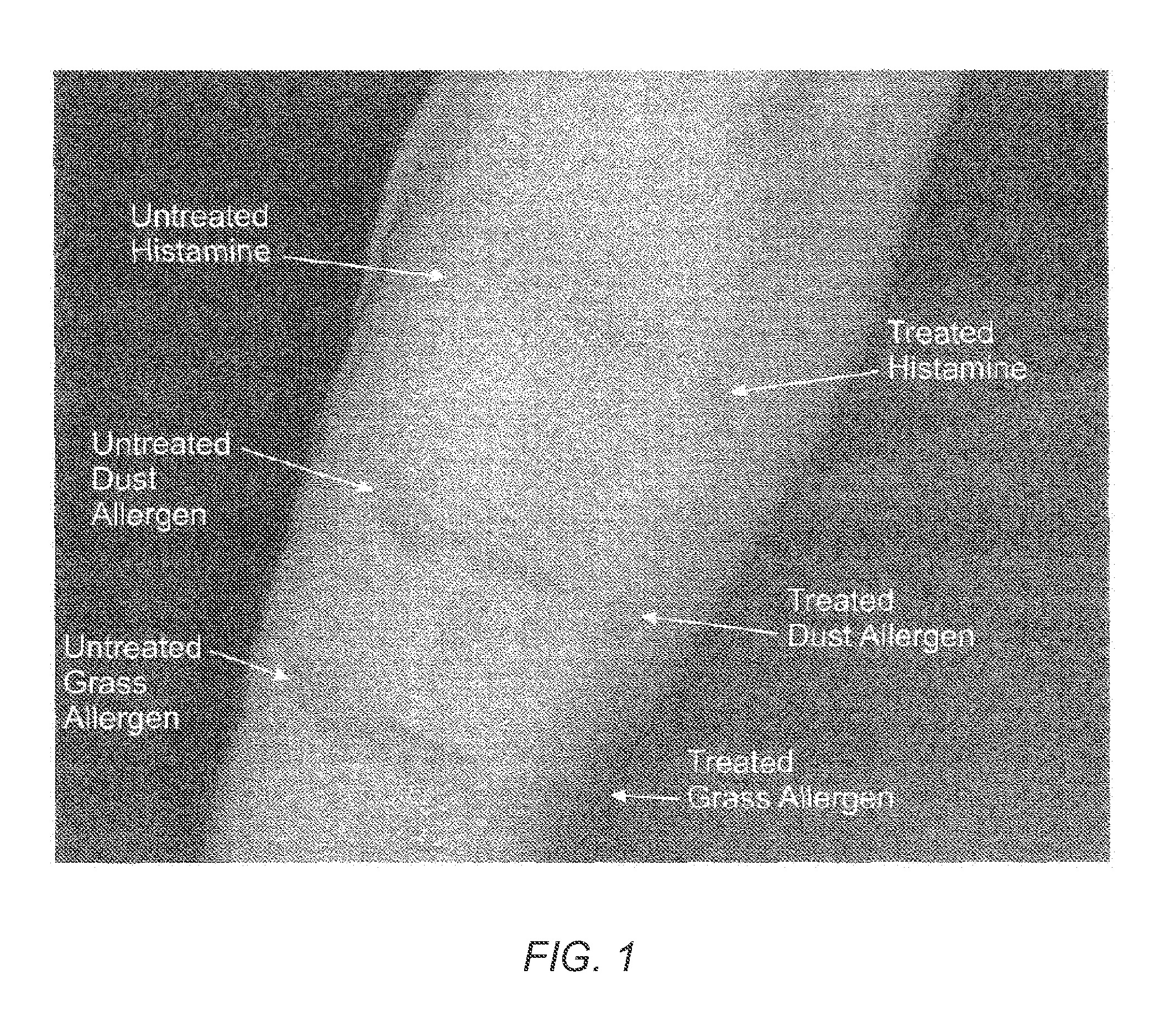 X-ray contrast media compositions and methods of using the same to treat, reduce or delay the onset of CNS inflammation and inflammation associated conditions