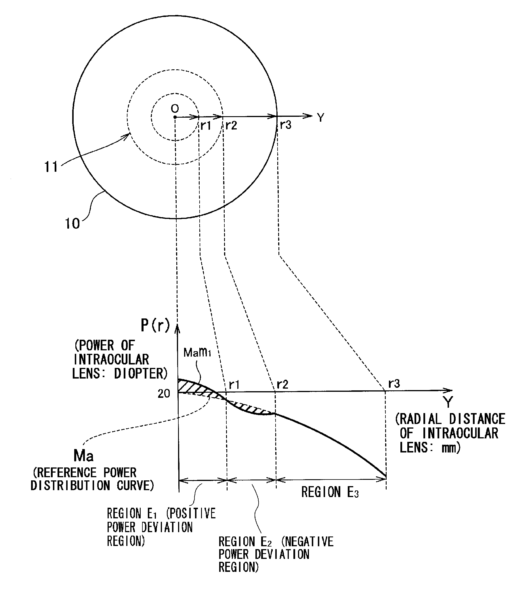 Intraocular lens