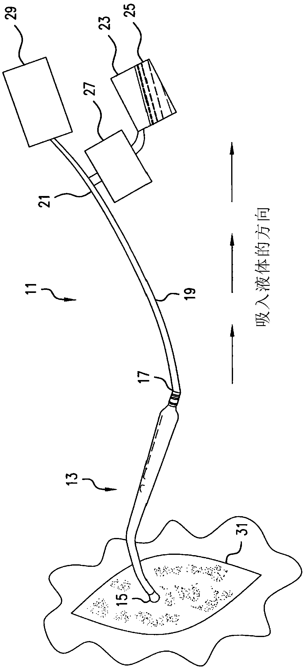 Yankauer suction system and related methods with clog removal functionality