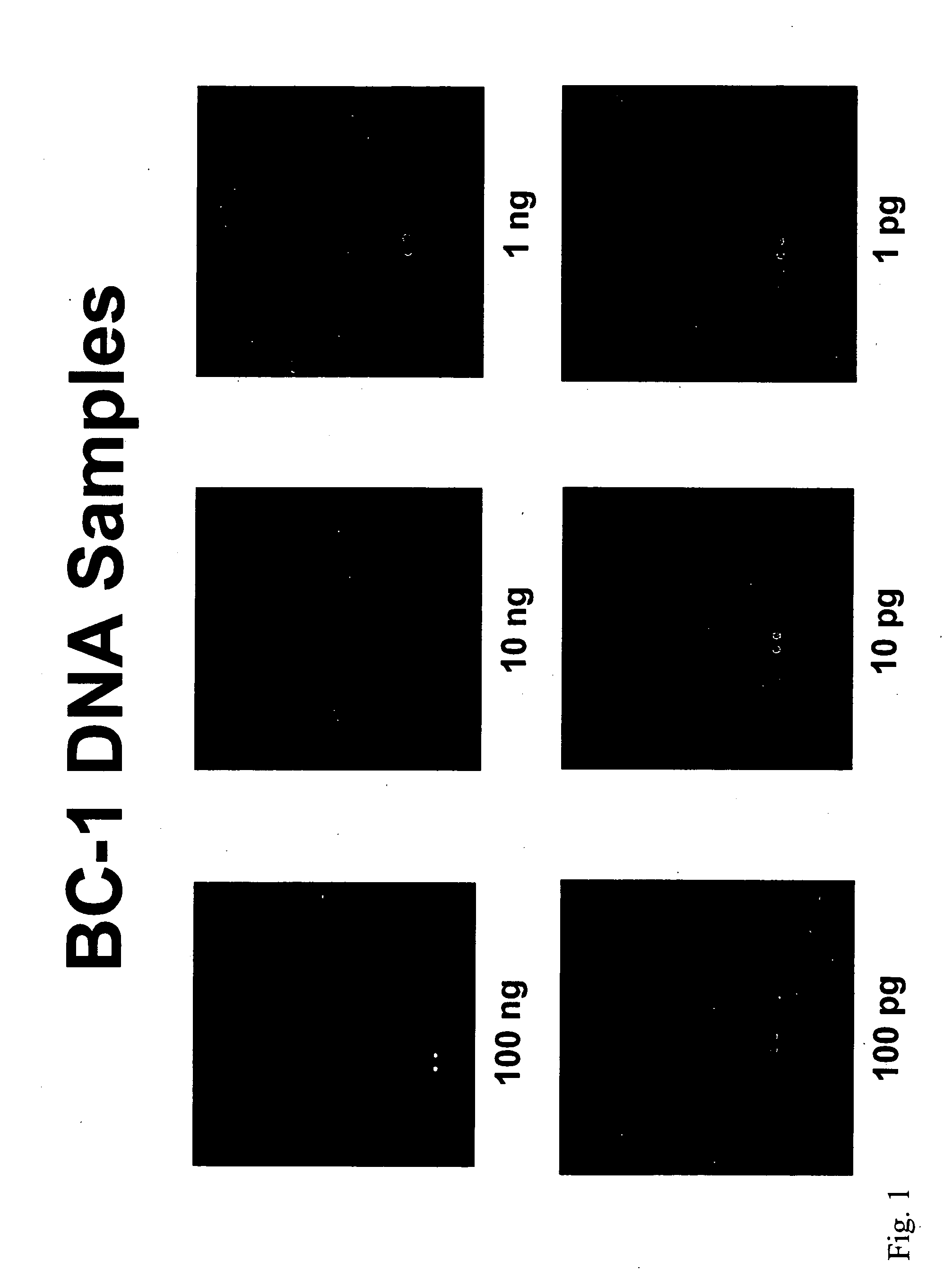 Detection of nucleic acids