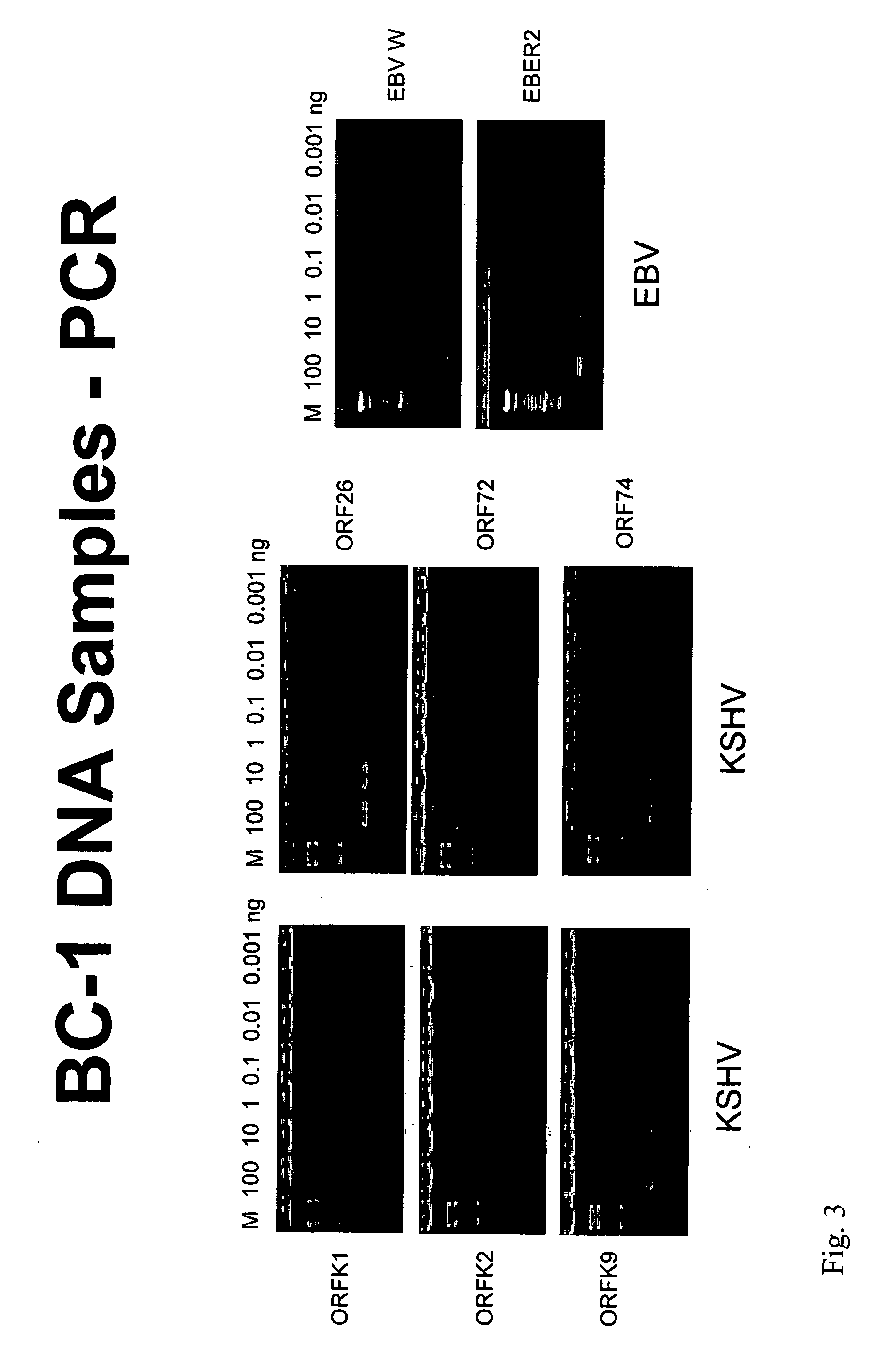 Detection of nucleic acids