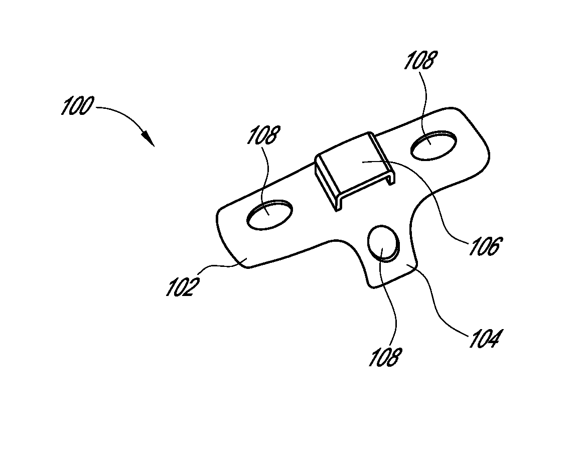 Method and device for reducing angular bone deformity using a bone stabilization plate and cerclage material