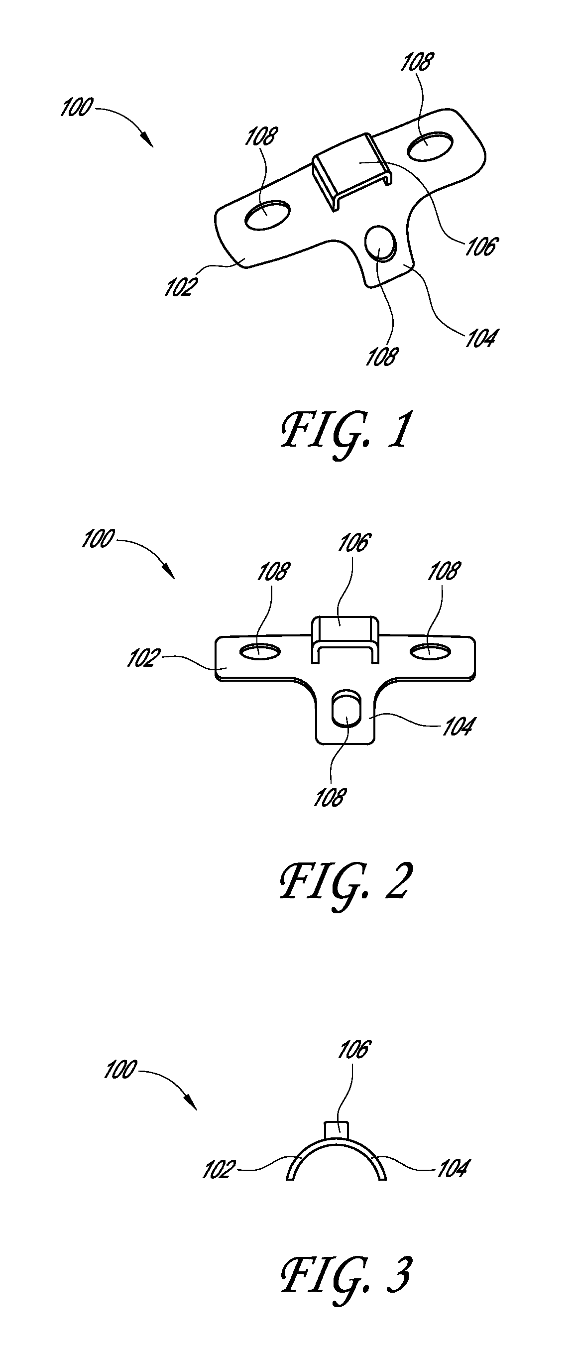 Method and device for reducing angular bone deformity using a bone stabilization plate and cerclage material