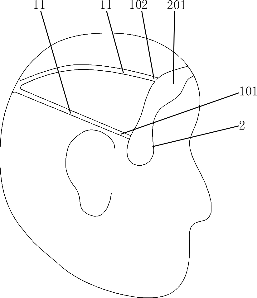 Face lifting device