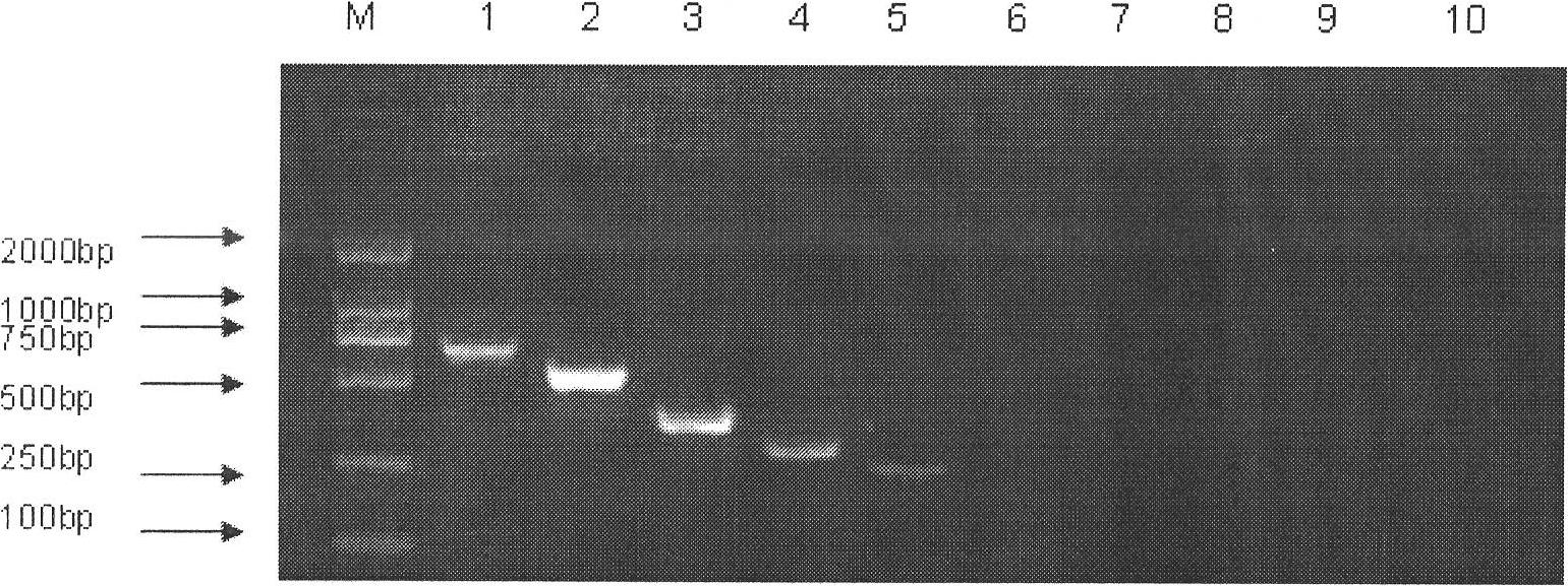 Specific primers and kit for detecting various serotype pathogenic bacteria of legionella pneumophilia