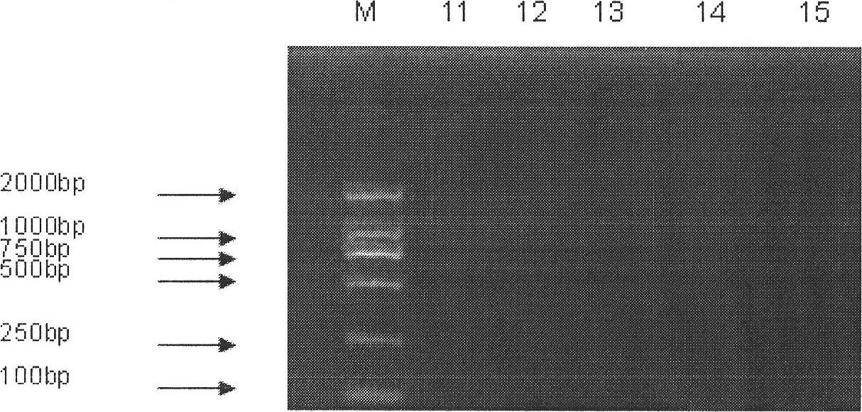 Specific primers and kit for detecting various serotype pathogenic bacteria of legionella pneumophilia