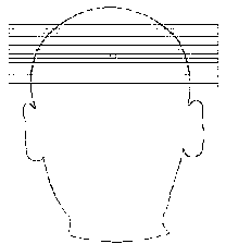 Three-dimensional graphical lamina positioning method in magnetic resonance imaging and magnetic resonance imaging system