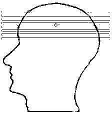 Three-dimensional graphical lamina positioning method in magnetic resonance imaging and magnetic resonance imaging system