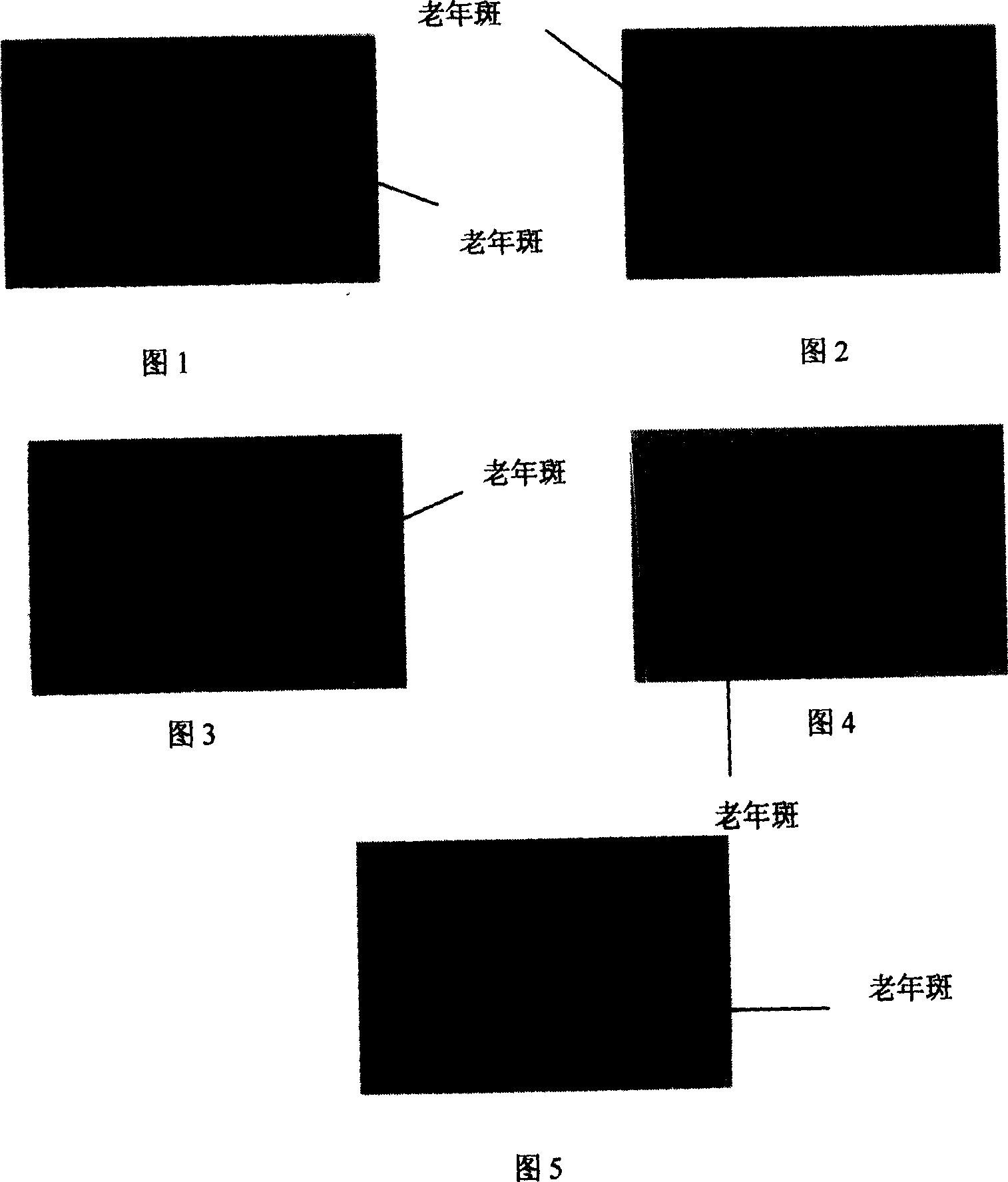 Application of biphenyl cyclooctene containing substance in the process for preparing Alzheimer disease treating medicine