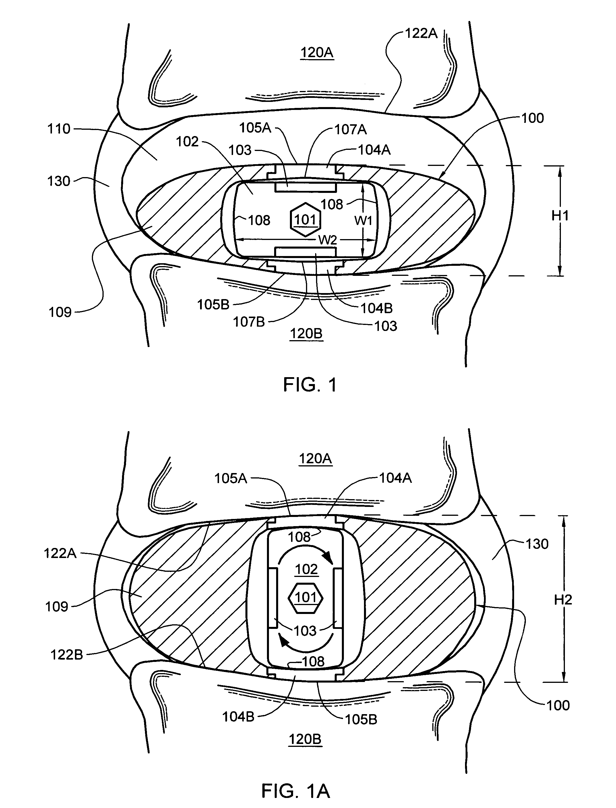 Intervertebral disc nucleus replacement implants and methods