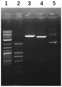 Engineering strain for producing recombinant human IL-1ra and preparation method and use thereof