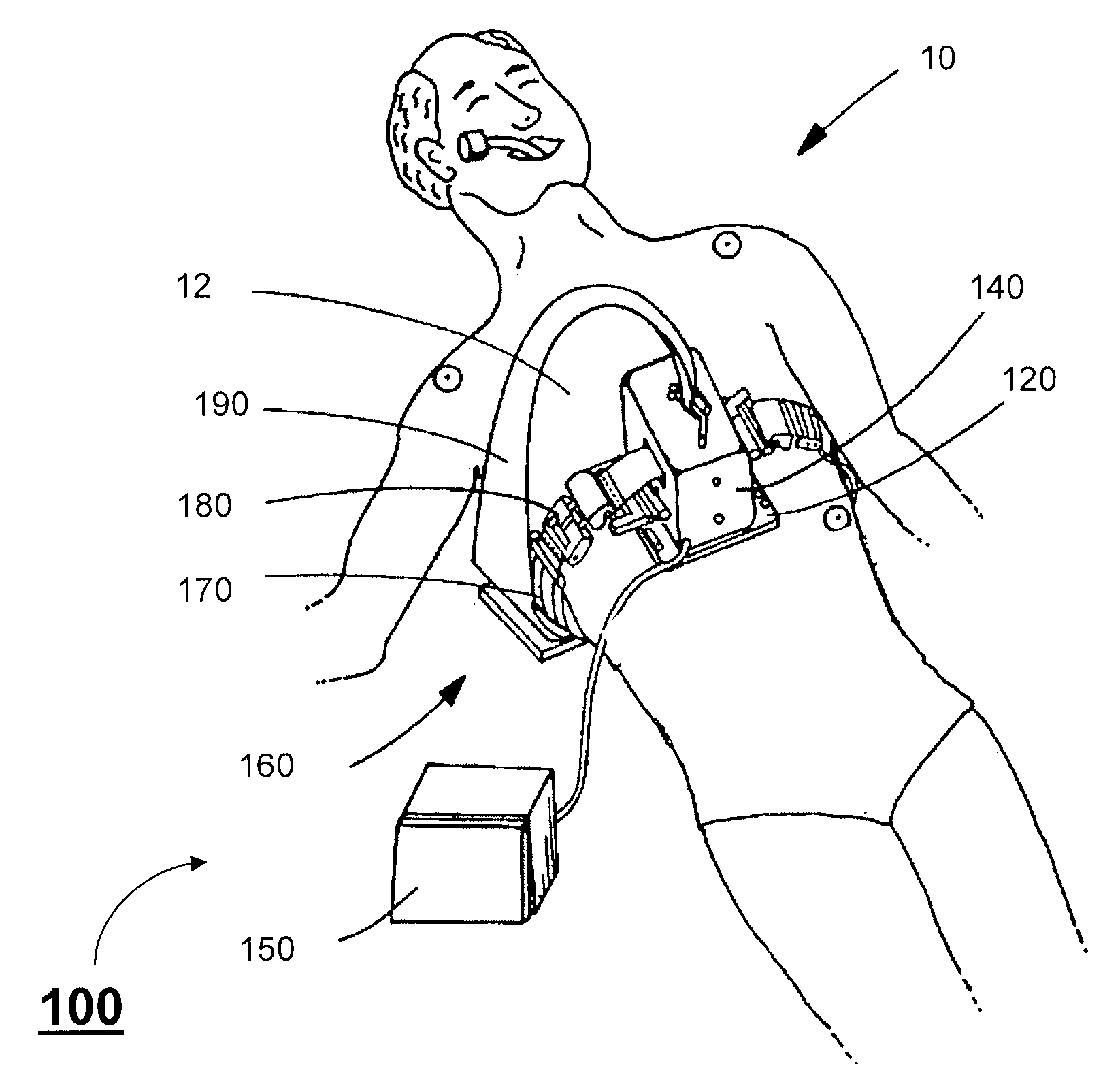 Optimal control of CPR procedure using hemodynamic circulation model