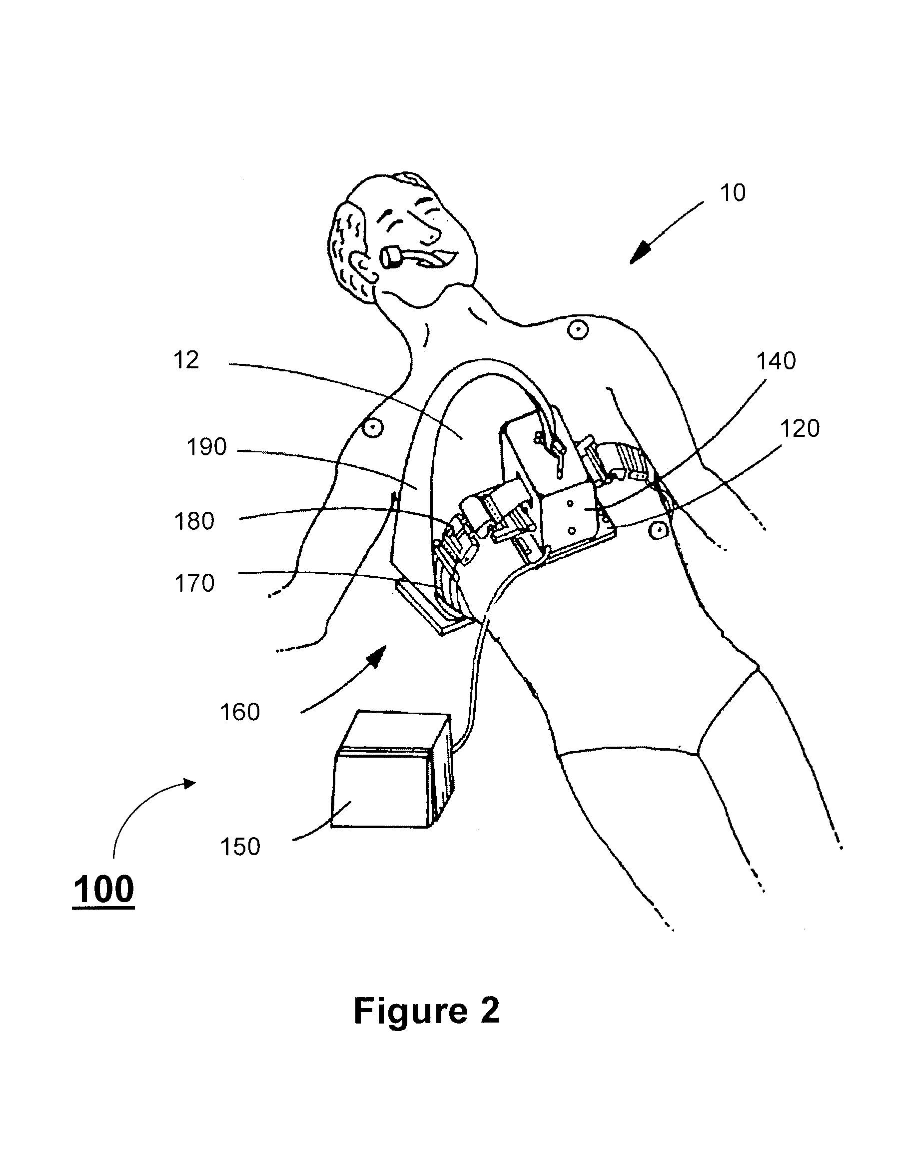 Optimal control of CPR procedure using hemodynamic circulation model