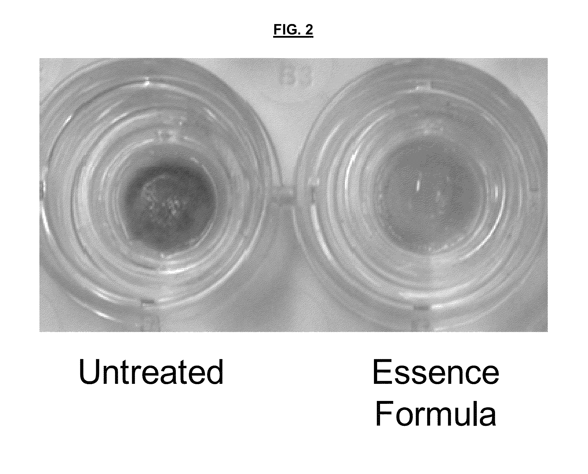 DICKKOPF-1 expression modulating compositions and uses thereof