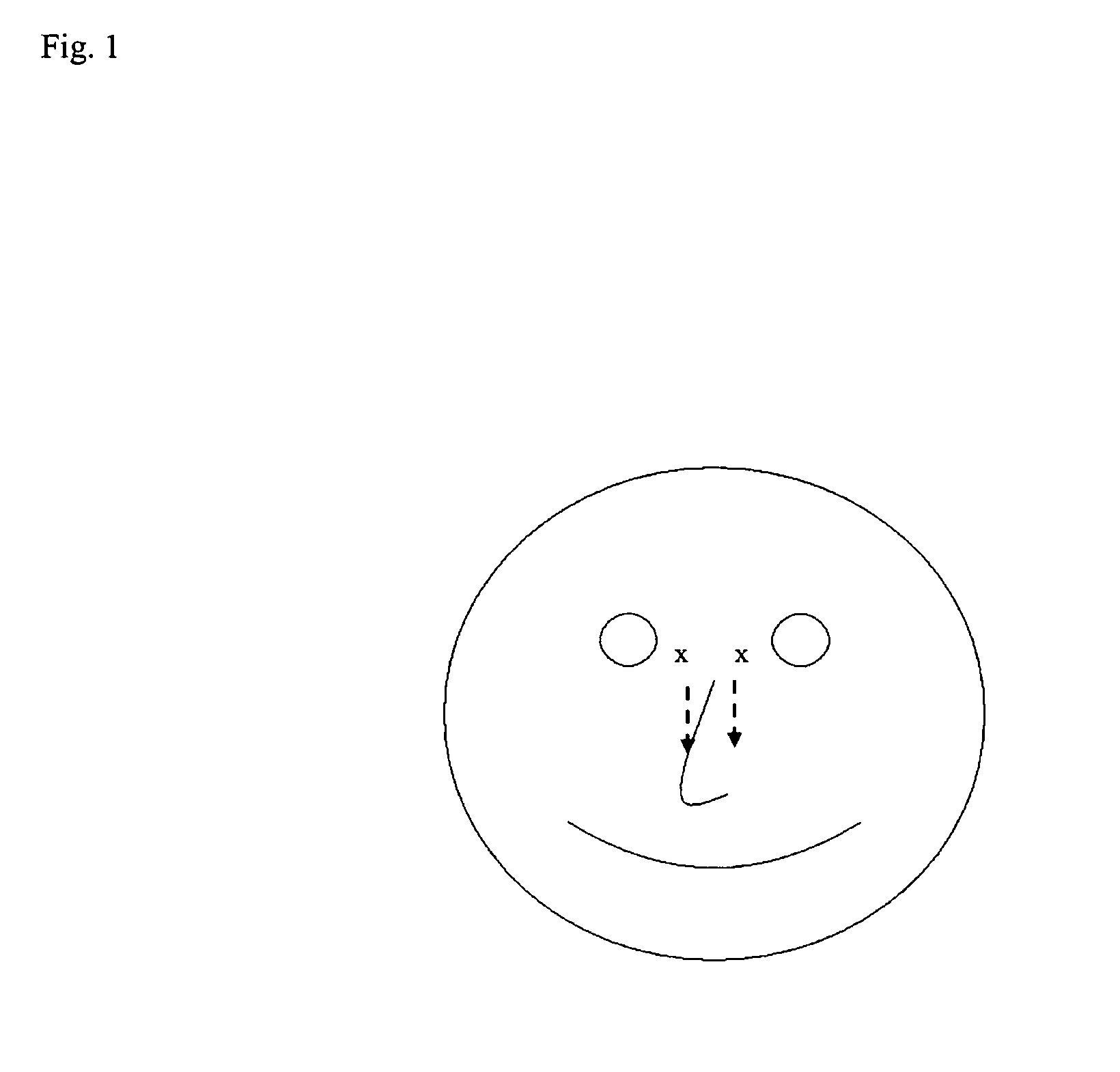 Method of collecting nasopharyngeal cells and secretions for diagnosis of viral upper respiratory infections and screening for nasopharyngeal cancer