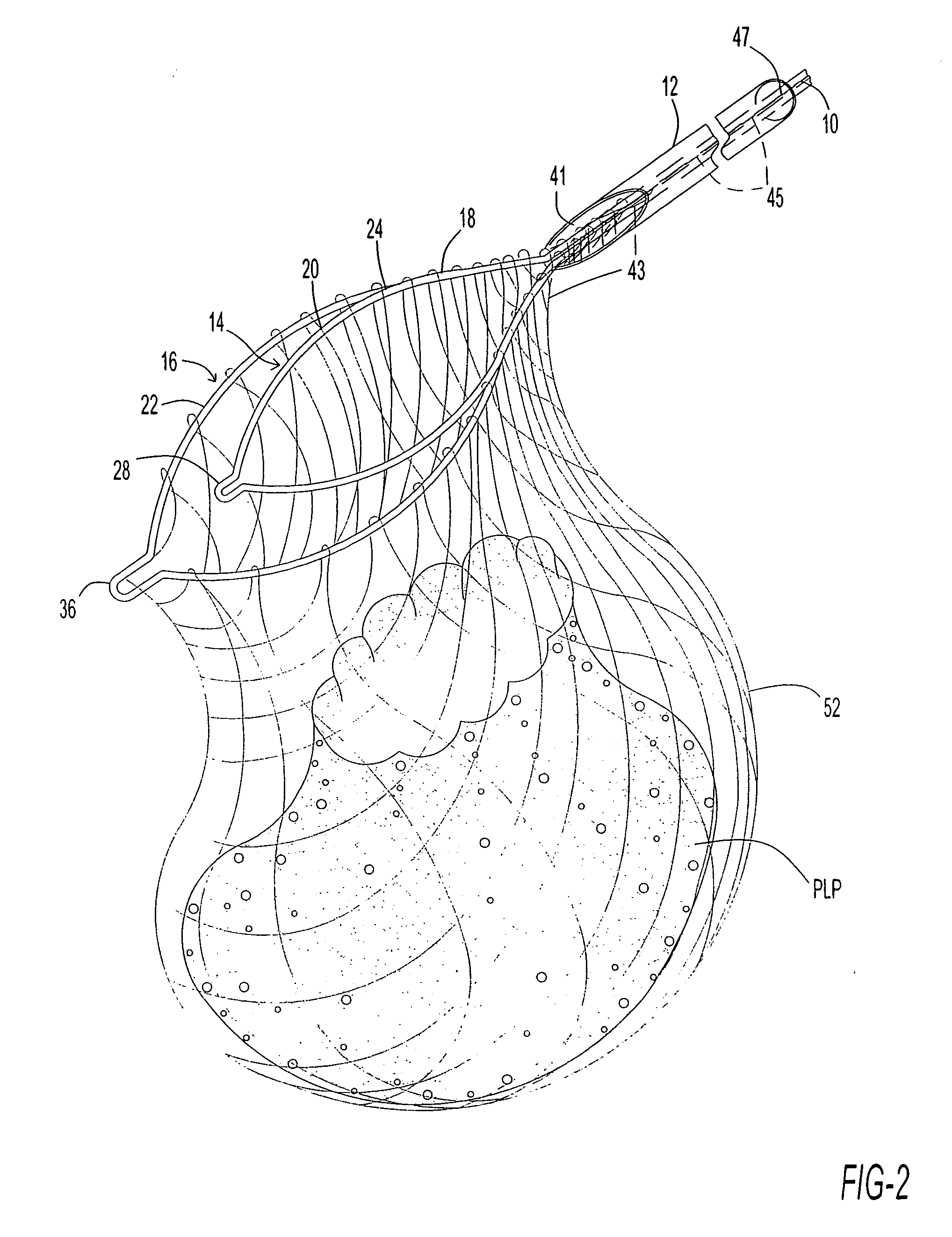 Endoscope cutting and retrieving snare instrument