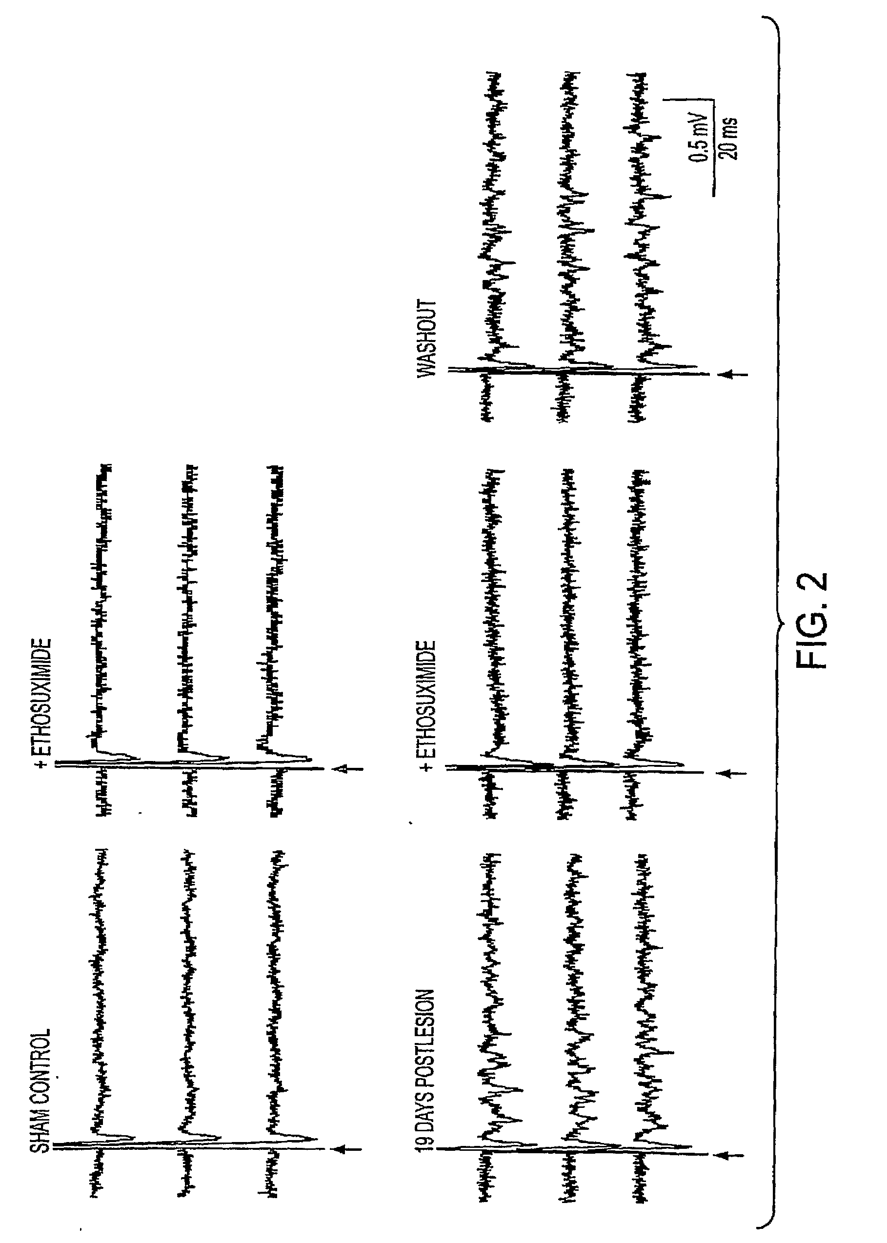 Method for treating central pain syndrom or for inducing centrally generated pain in an animal model