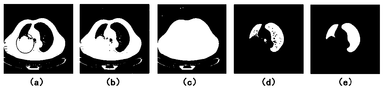 Lung tumor segmentation method for large-area adhesion of lung boundary tissue in CT image