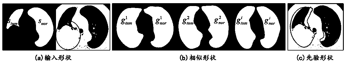 Lung tumor segmentation method for large-area adhesion of lung boundary tissue in CT image