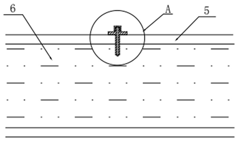 A medical intramedullary venous return device