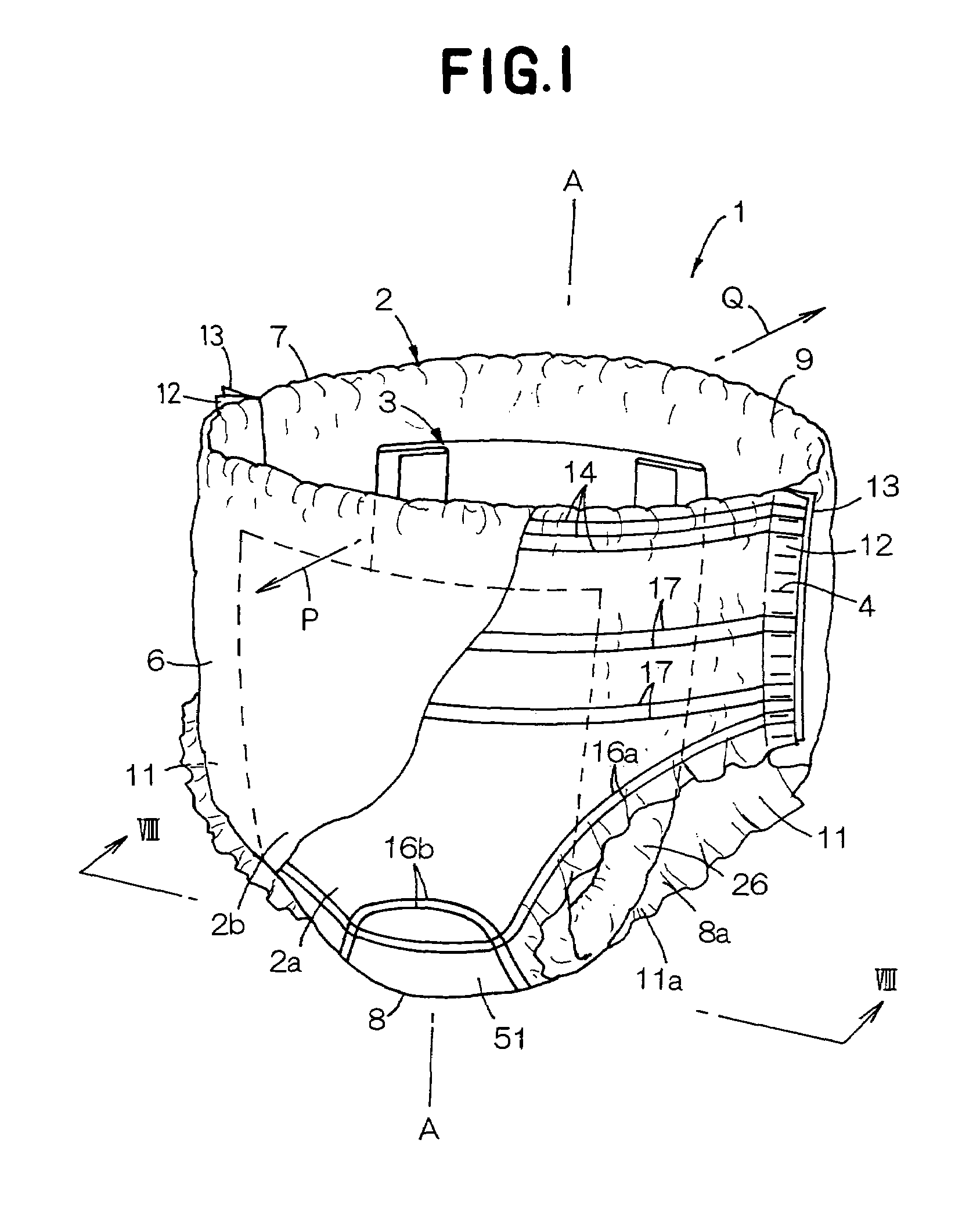 Disposable wearing article having multilayered core comprising convex gaps and v-shaped cutouts