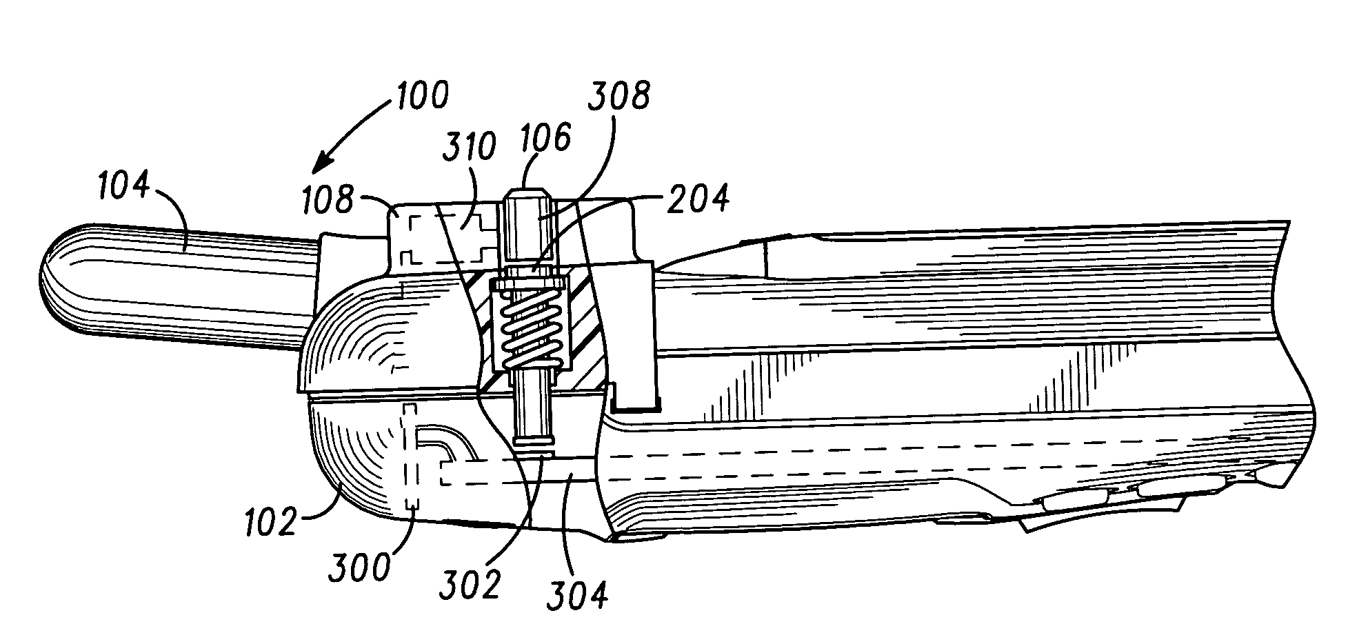 Detachable antenna module