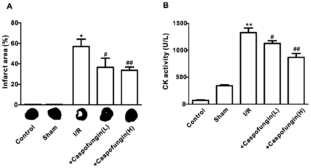 Application of caspofungin in preparation of medicine for treating ischemia/reperfusion injury