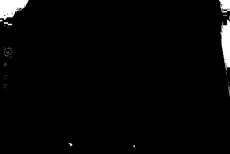 Genetic recombinant human-like collagen