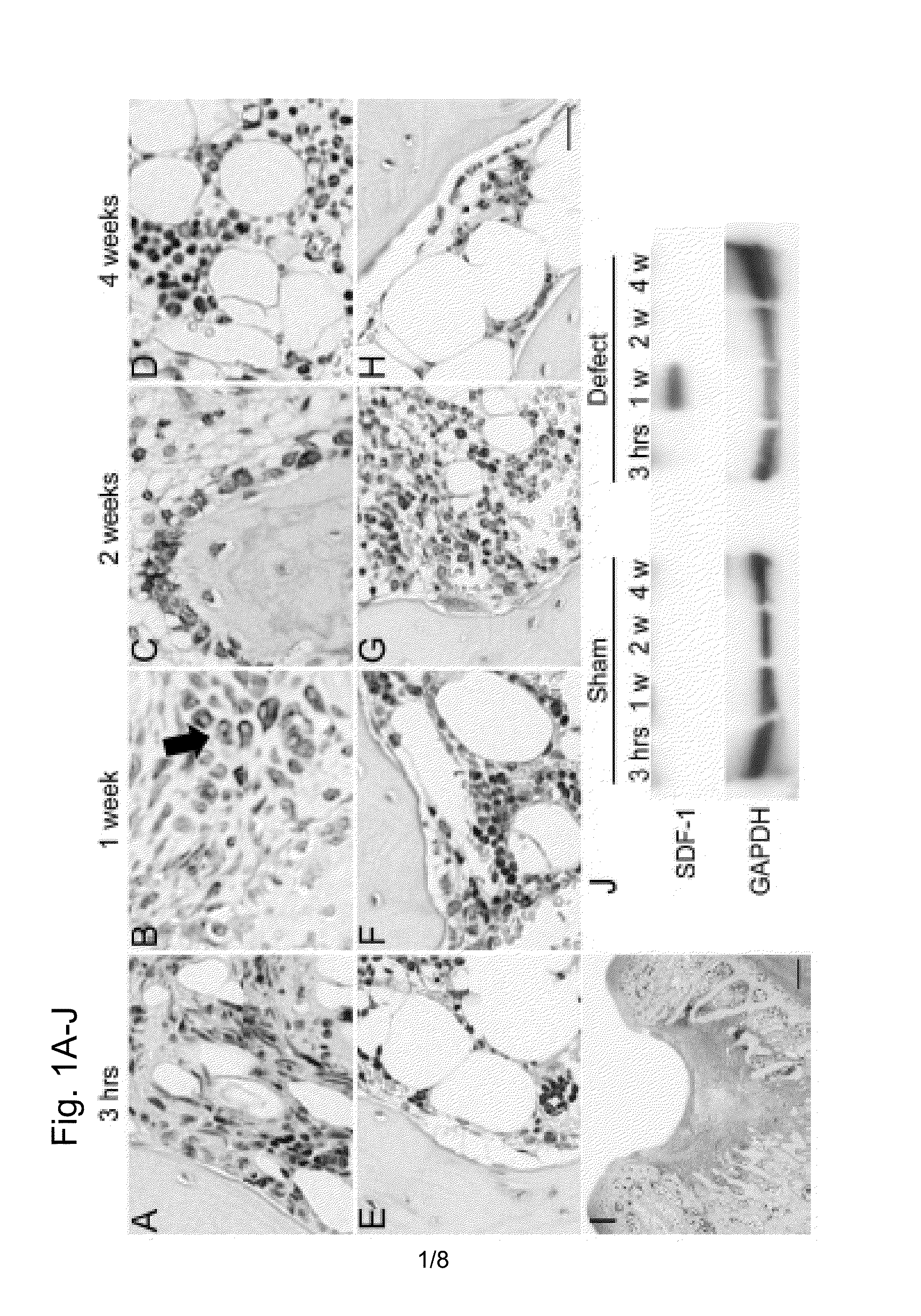 Composition for regeneration of cartilage