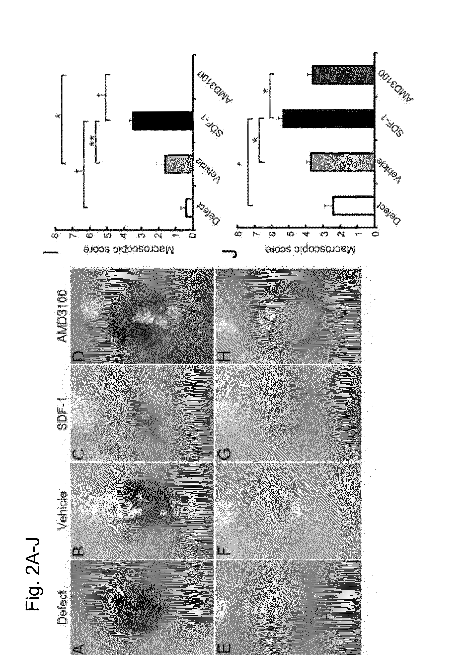 Composition for regeneration of cartilage